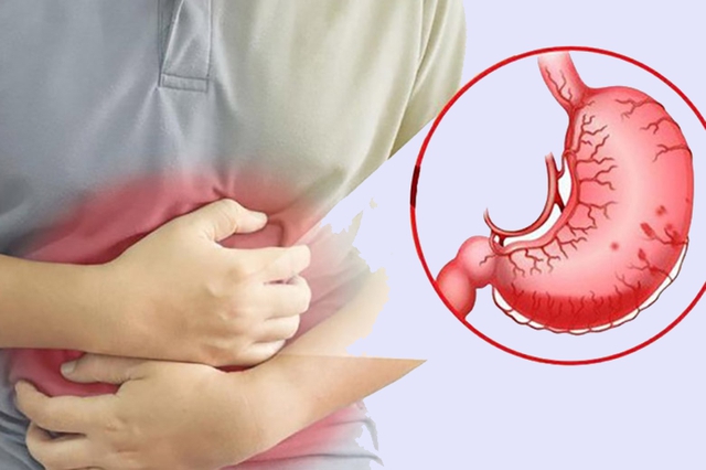 Bổ sung men vi sinh có chứa L. reuteri đã được chứng minh là có tác dụng hữu ích chống lại nhiễm trùng Helicobacter pylori ở người.
