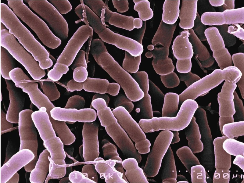 Lợi khuẩn Bifidobacterium